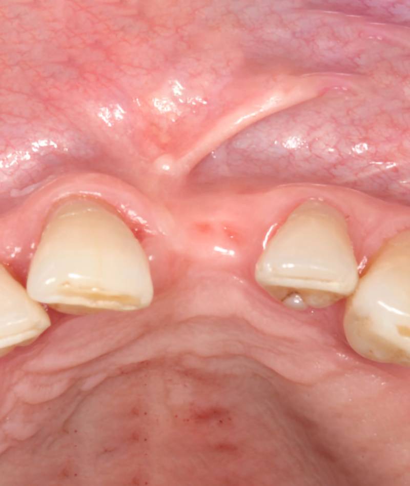 osso_verticale01_mob