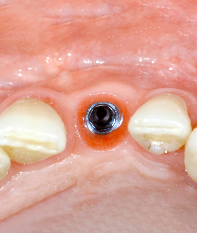 osso_verticale02_mob