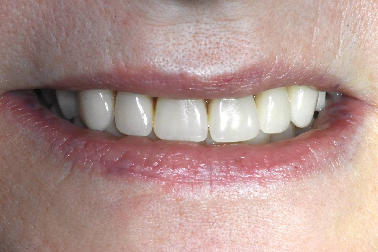 miniimpianti_03_desk